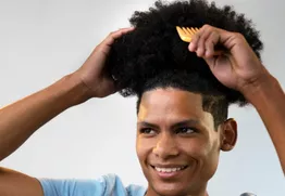 Afro Hair Transplant in Miami: Technique, Curl Preservation, and Healing Timeline