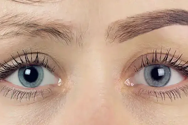 Eyebrow Transplant Miami