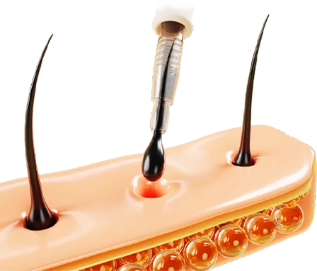 haircomes-back-gorsel